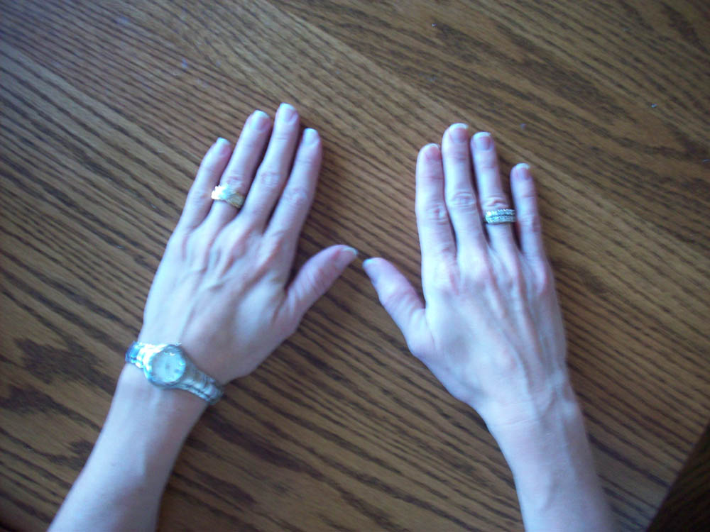 Hand Image